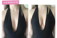 将图片加载到图库查看器,Lift Up Invisible Bra Tape - 1 Pair - A pot of wine