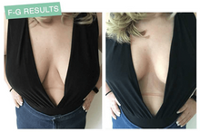 将图片加载到图库查看器,Lift Up Invisible Bra Tape - 1 Pair - A pot of wine