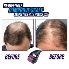 将图片加载到图库查看器,Hair Re-Activating Roller