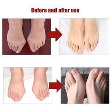 将图片加载到图库查看器,Adjustable Bunion Corrector-Perfect Pain Relief