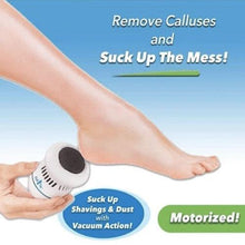 将图片加载到图库查看器,Vacuum Callus Remover And Collector