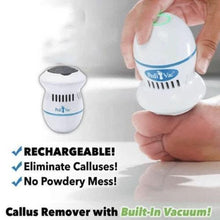 将图片加载到图库查看器,Vacuum Callus Remover And Collector