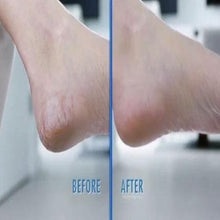 将图片加载到图库查看器，Vacuum Callus Remover And Collector
