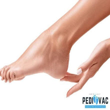 将图片加载到图库查看器，Vacuum Callus Remover And Collector
